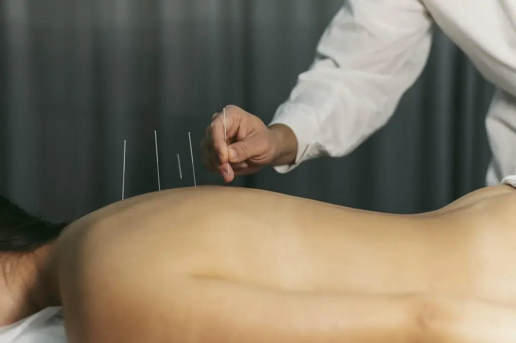 Acupuncturist in barneveld